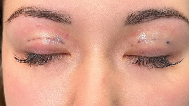 手术前的状态 其一