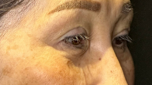 手术前的状态 其一