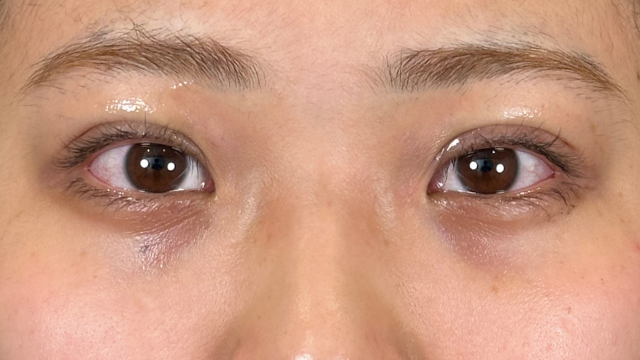 Postoperative Condition Part 1