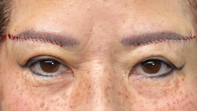 Postoperative Condition Part 1