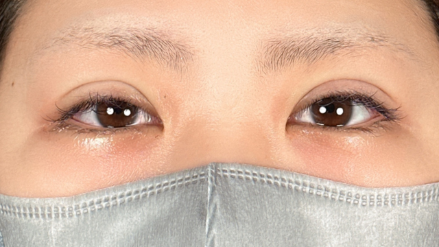 手术前的状态 其一