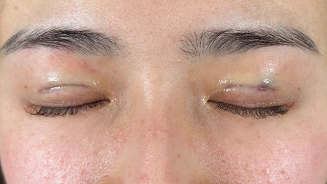 手术前的状态 其一