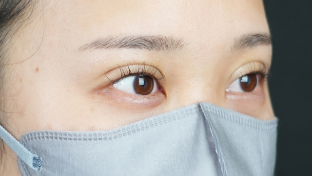 手術前の状態 その1