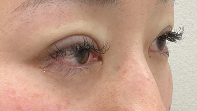 手术前的状态 其一