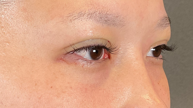 Postoperative Condition Part 1