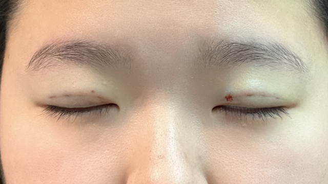 手术前的状态 其一