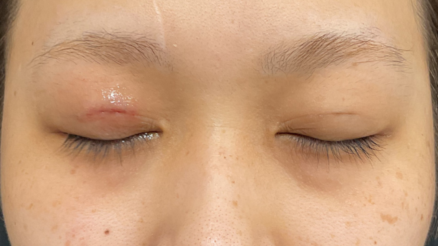 手术前的状态 其一