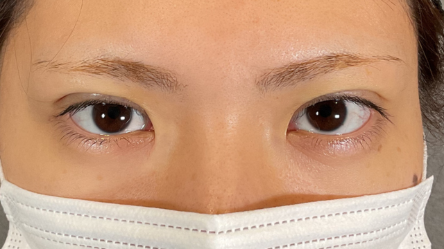 手术前的状态 其一