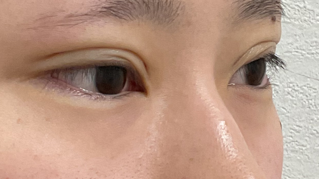 Postoperative Condition Part 1