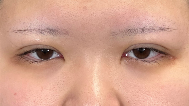 手术前的状态 其一