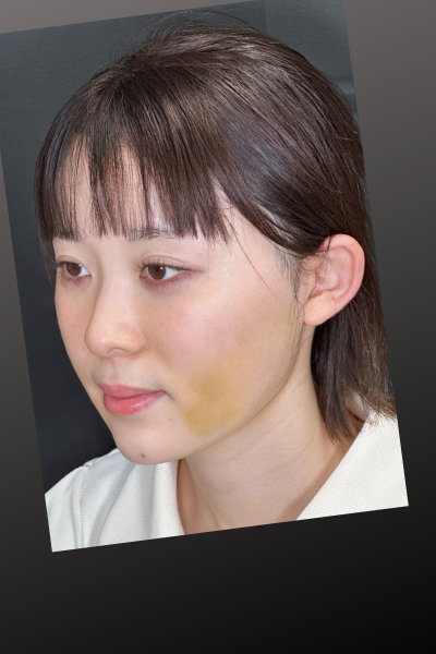 手術前の状態 その1