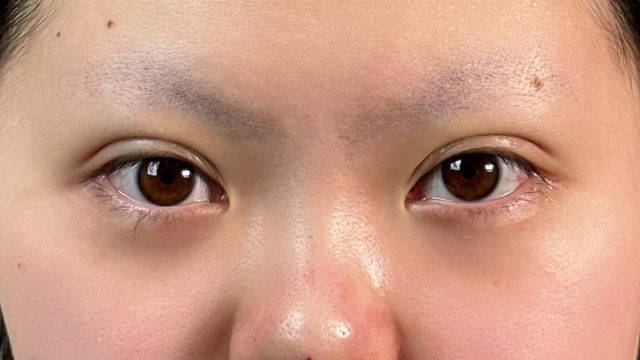 手术前的状态 其一