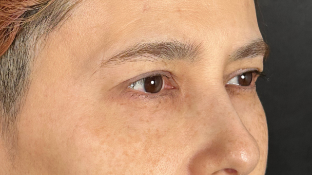 手术前的状态 其一