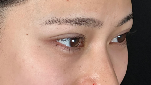 手术前的状态 其一