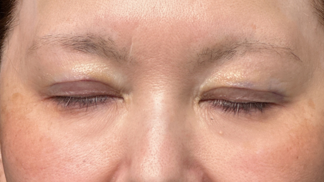 手术前的状态 其一