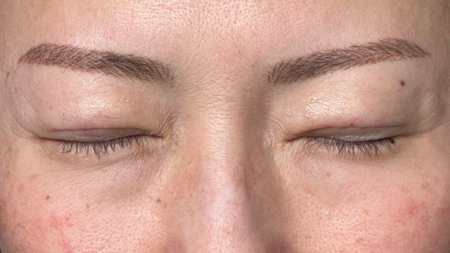 手术前的状态 其一