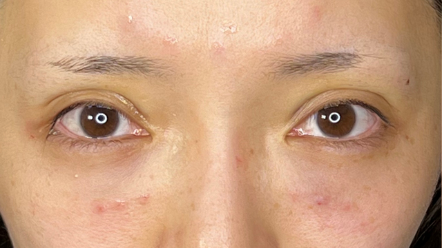 Postoperative Condition Part 1