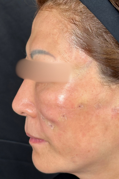 手术前的状态 其一