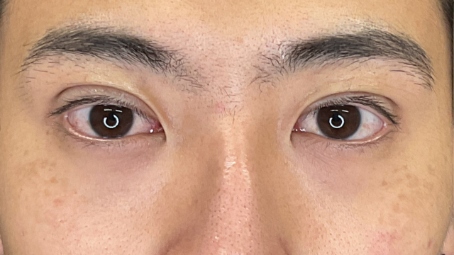 手术前的状态 其一