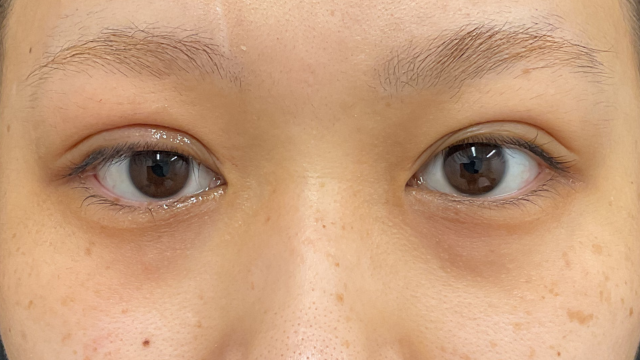 手术前的状态 其一