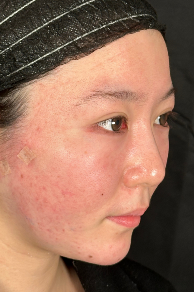 手術前の状態 その1