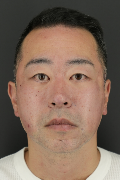 手術前の状態 その1