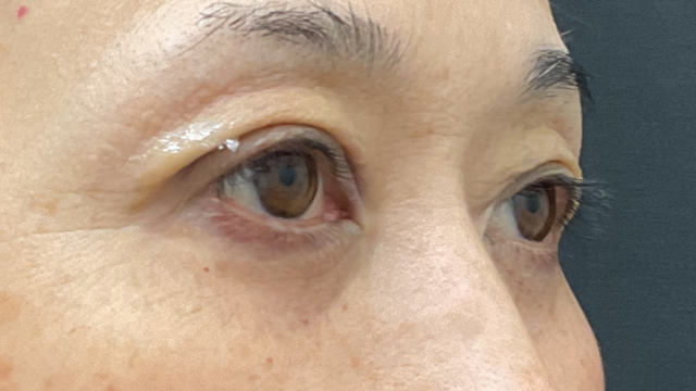 手术前的状态 其一