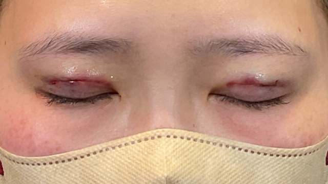 手术前的状态 其一