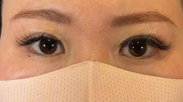 手术前的状态 其一