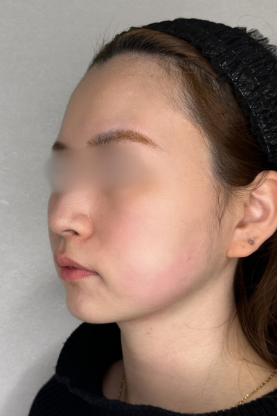 手術前の状態 その1