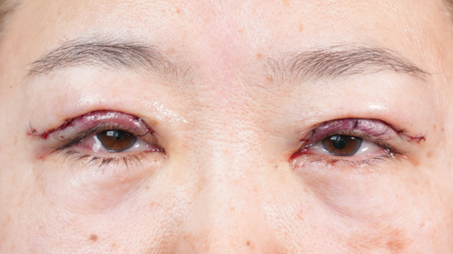 Postoperative Condition Part 1