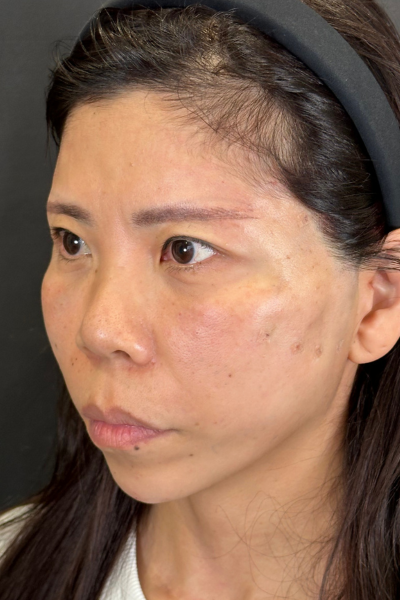 手術前の状態 その1