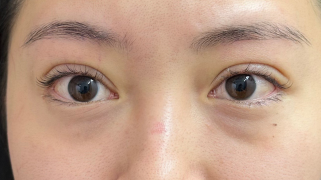 手术前的状态 其一