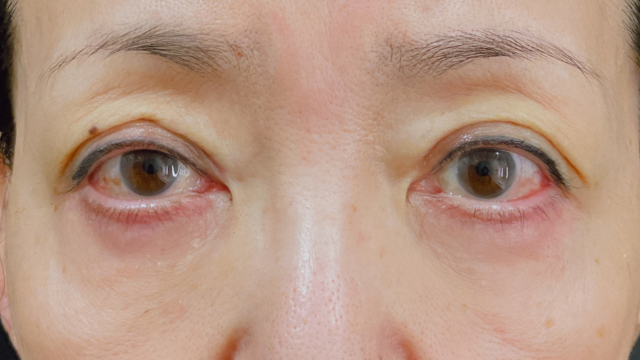 Postoperative Condition Part 1