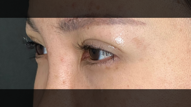 Postoperative Condition Part 1