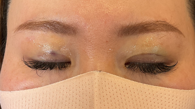 手术前的状态 其一