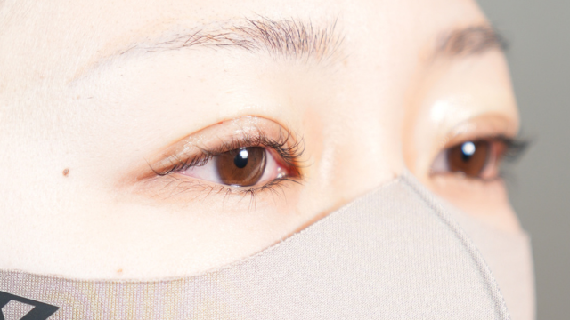 手術前の状態 その1