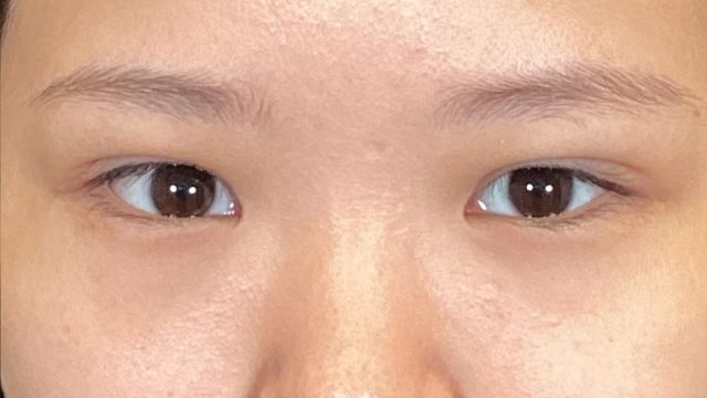 Postoperative Condition Part 1