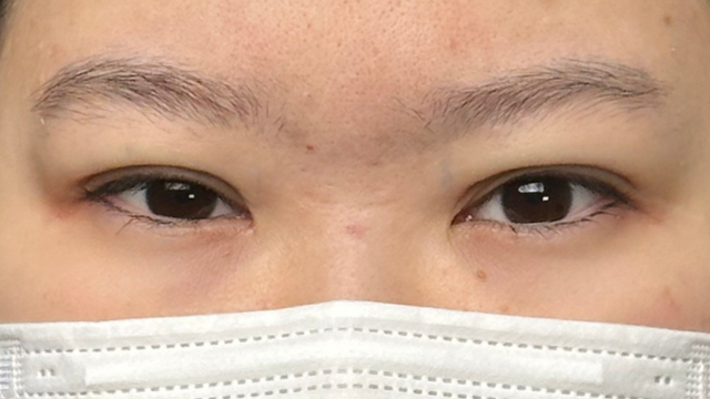 Postoperative Condition Part 1