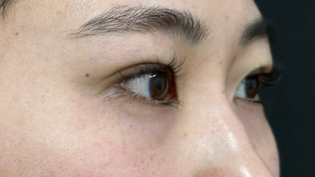 手术前的状态 其一