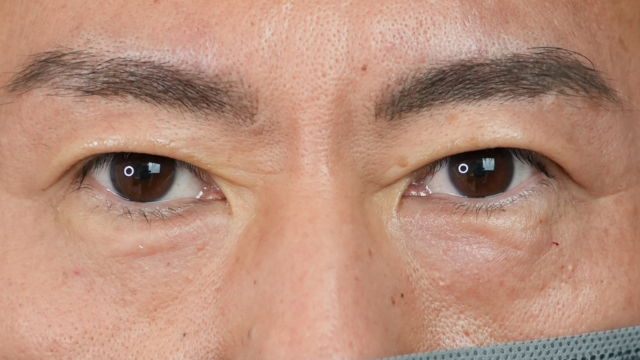 手术前的状态 其一