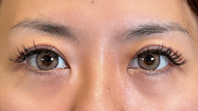 Postoperative Condition Part 1