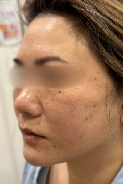 手術前の状態 その1