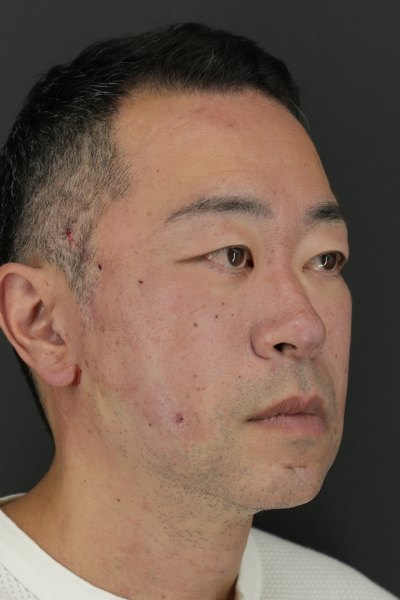 手術前の状態 その1