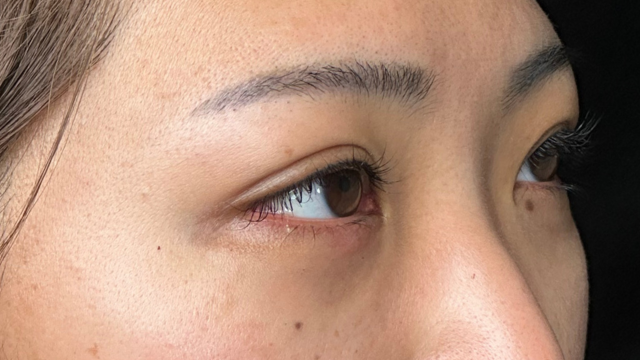 Postoperative Condition Part 1