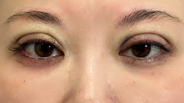 手术前的状态 其一