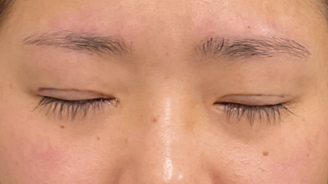 手术前的状态 其一