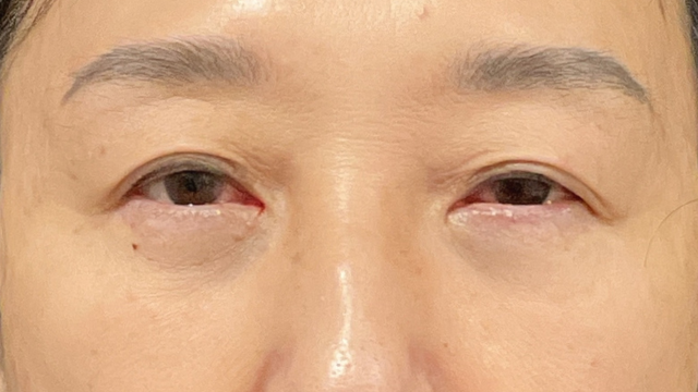 手术前的状态 其一