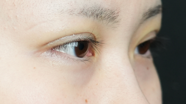 手术前的状态 其一