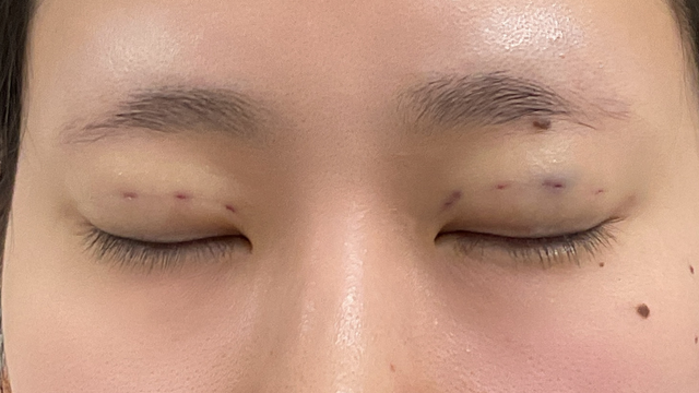 Postoperative Condition Part 1